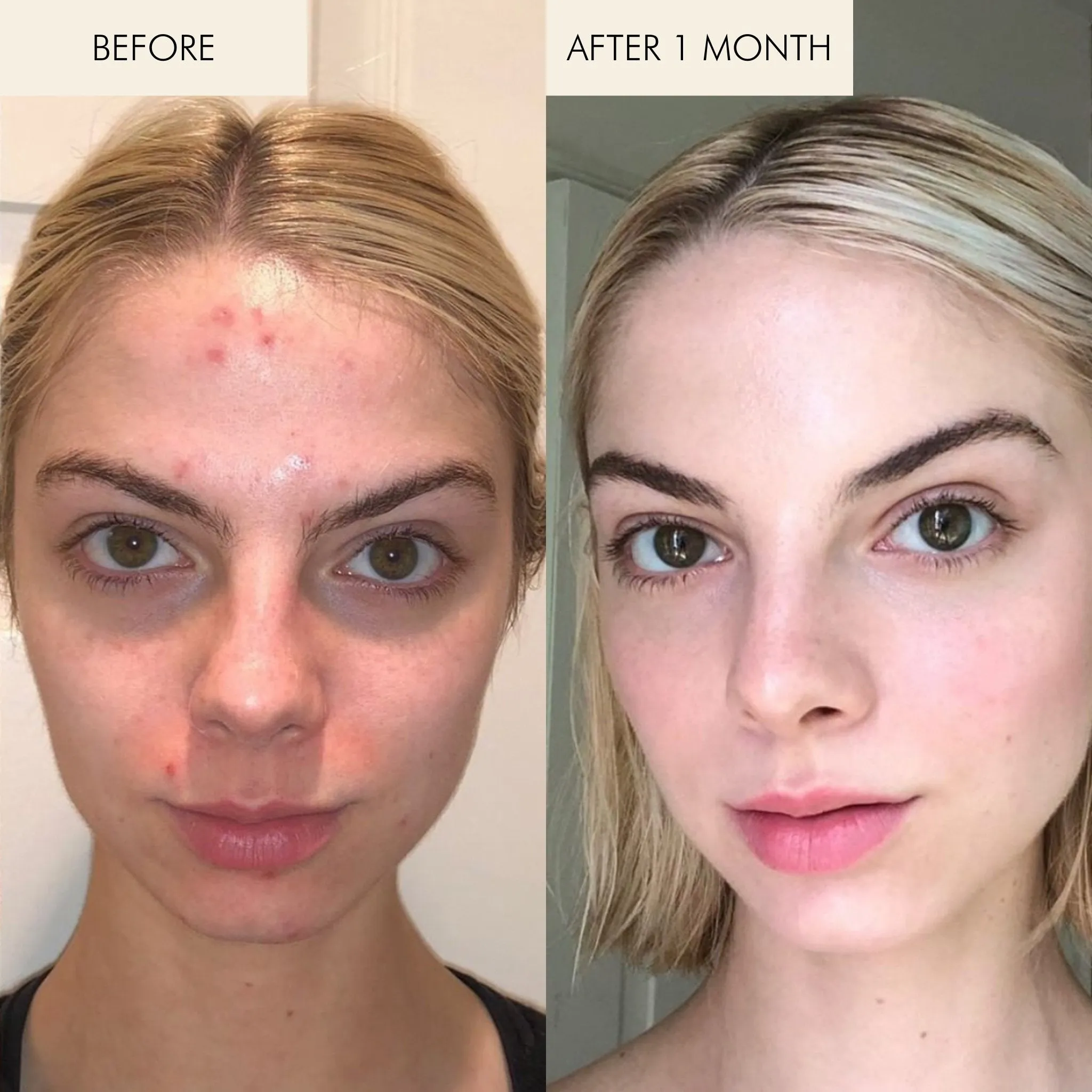 Evening Primrose   Green Tea Algae Retinol Face Oil
