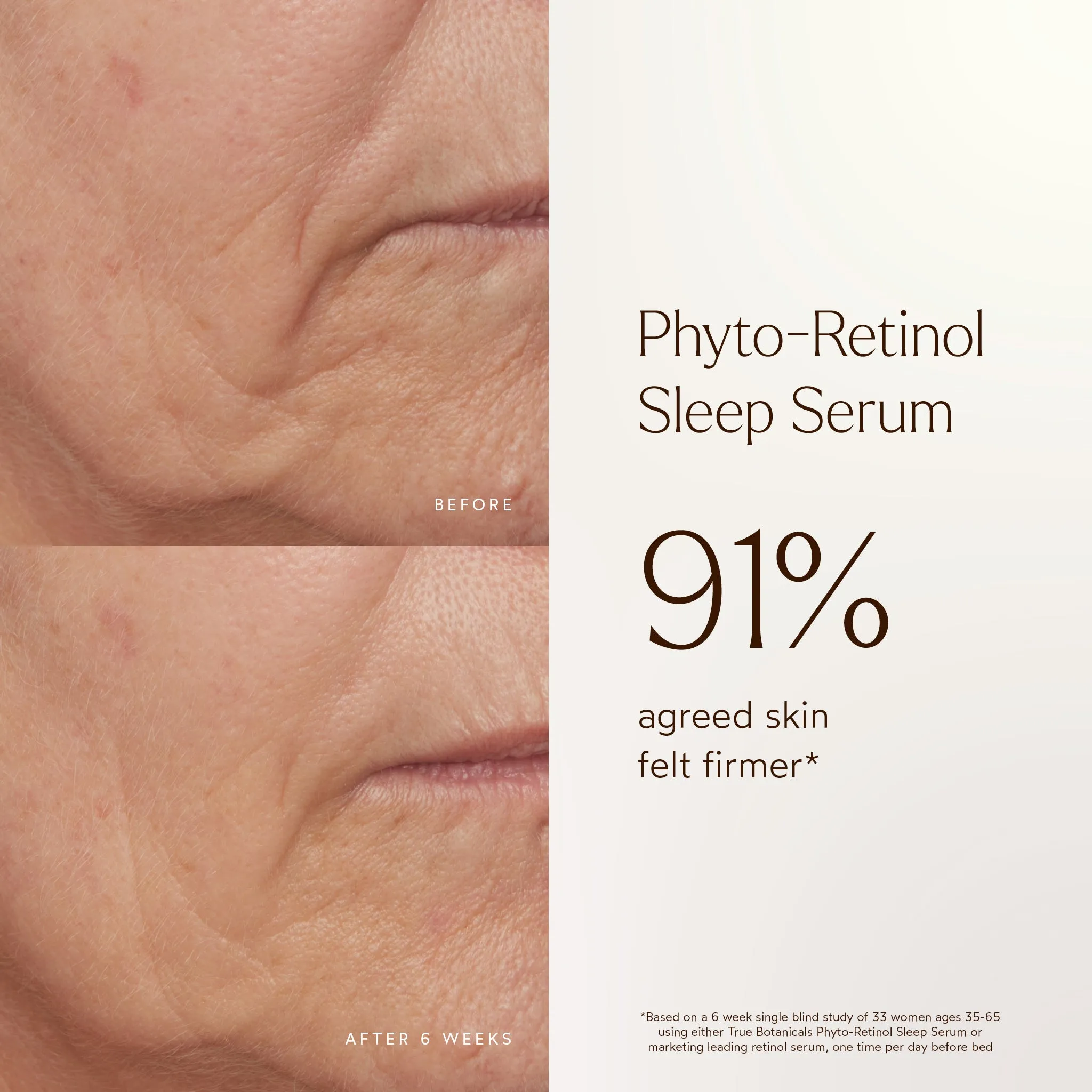 Phyto-Retinol Anti-Aging Sleep Serum