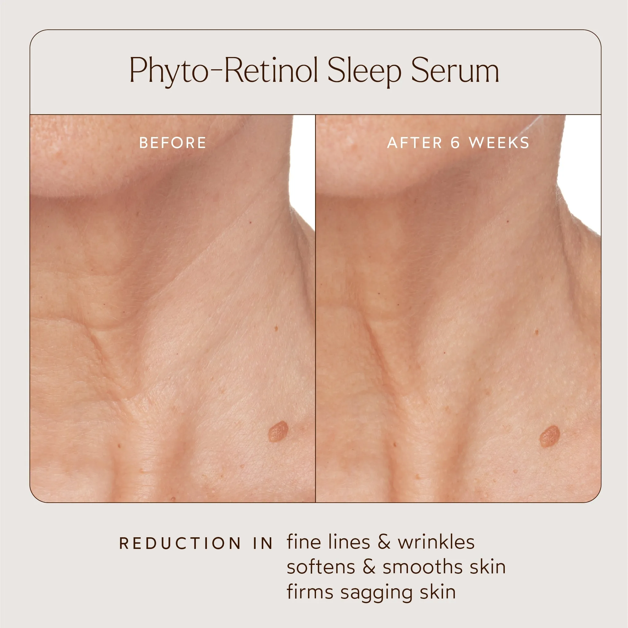 Phyto-Retinol Anti-Aging Sleep Serum