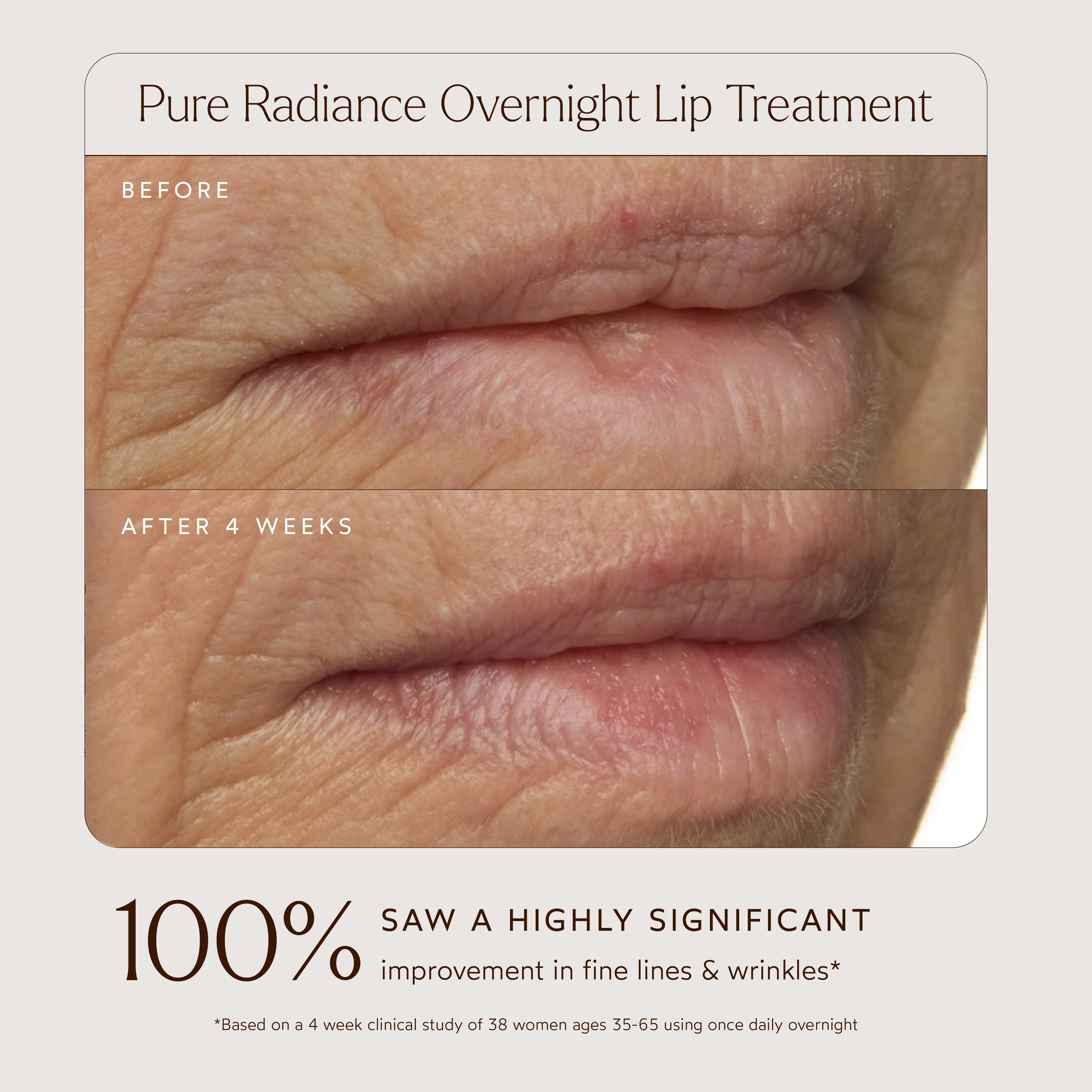 Pure Radiance Overnight Lip Treatment